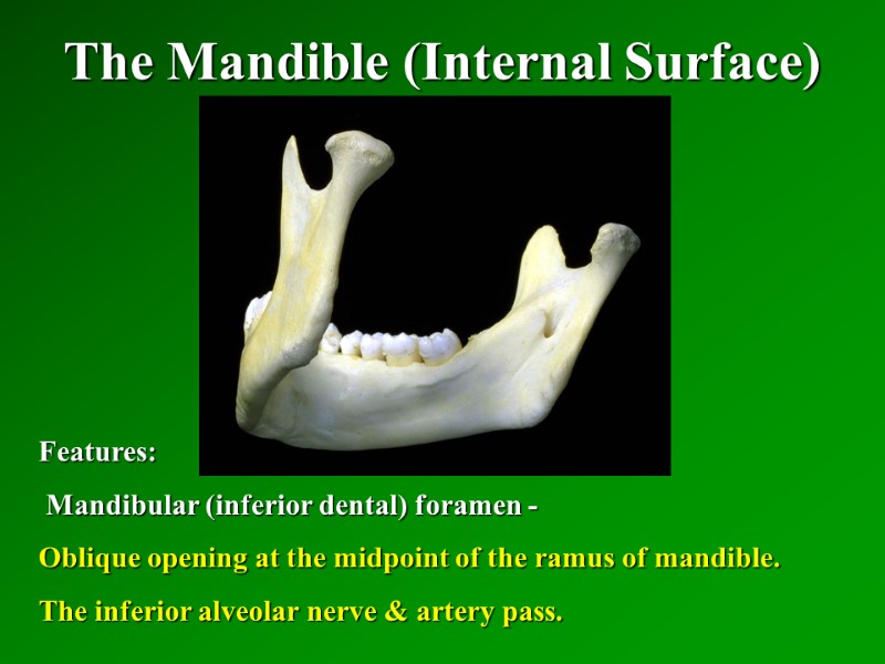 The Mandible (Internal Surface)   Features:  Mandibular (inferior dental) foramen - Oblique